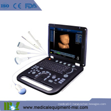 MSLCU18K Color doppler Portable ultrasound for pregnancy